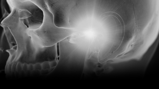 Radiographic-style image of the skull focusing on the temporomandibular joint area