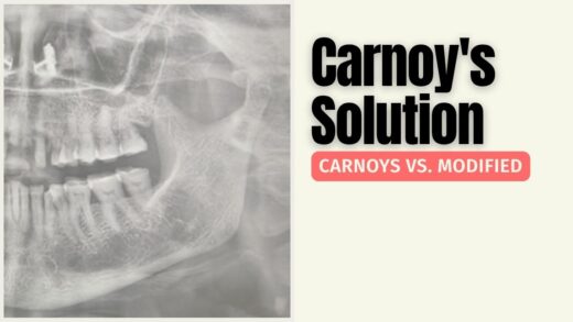 Carnoy’s Solution vs. Modified Carnoy’s – X-ray of jaw highlighting use in oral surgery and conservative management of jaw lesions