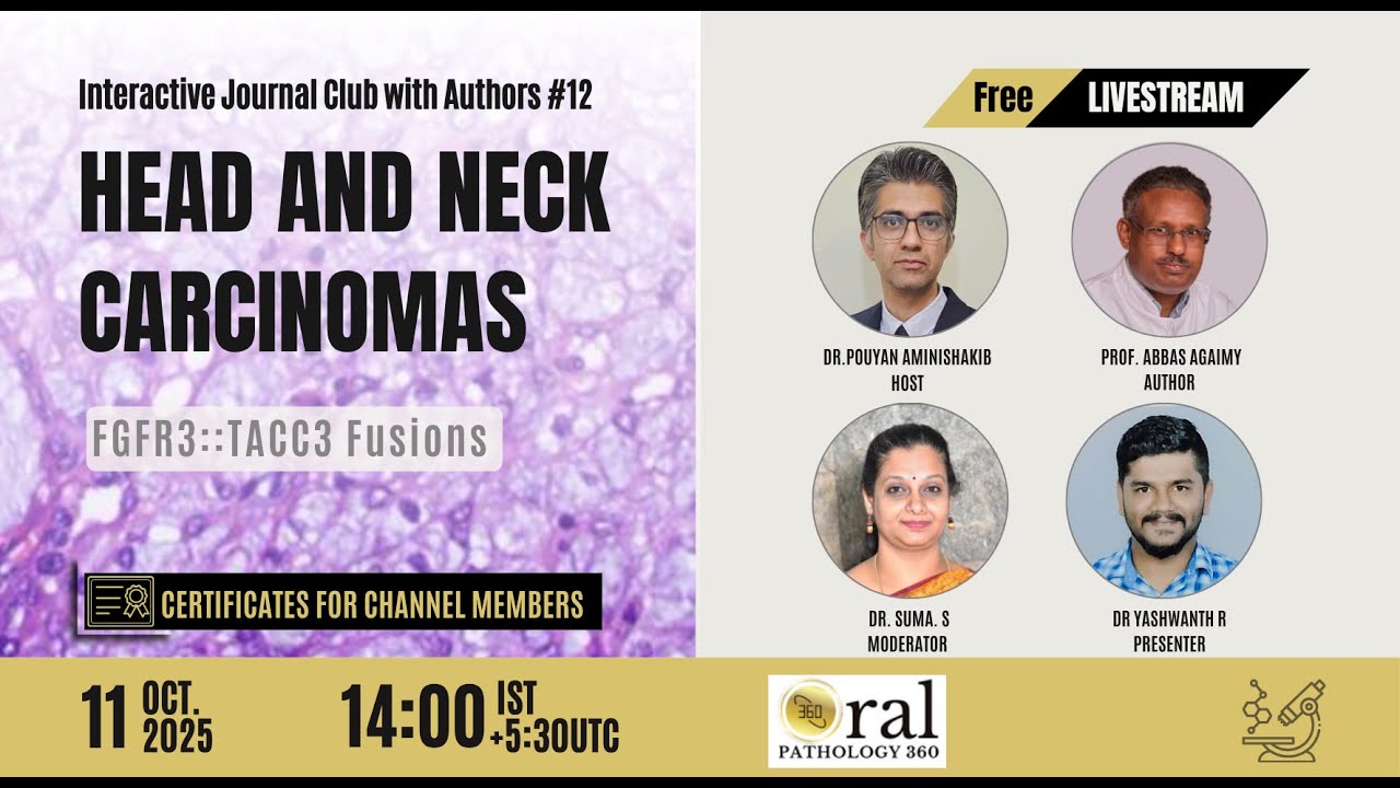 FGFR3::TACC3 fusions in head and neck carcinomas – Journal Club with Authors 12 Oral Pathology 360